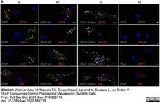 Anti Mouse CD206 Antibody, clone MR5D3 gallery image 21