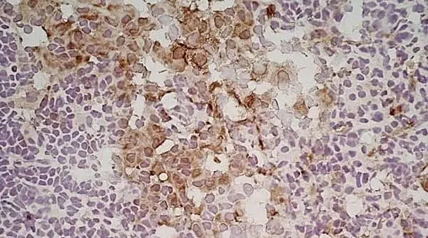 Anti Mouse CD206 Antibody, clone MR5D3 gallery image 3