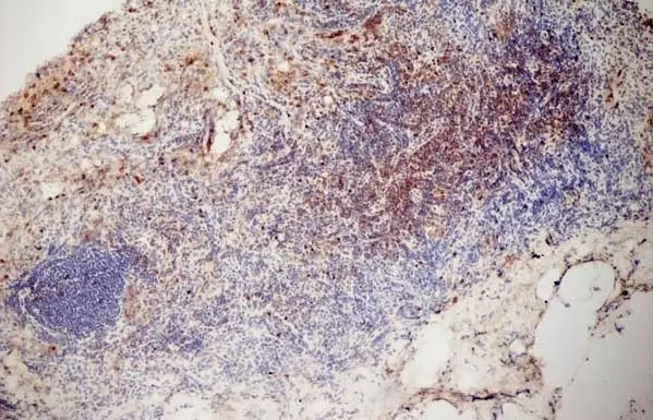 Anti Mouse CD3 Antibody, clone KT3 gallery image 10