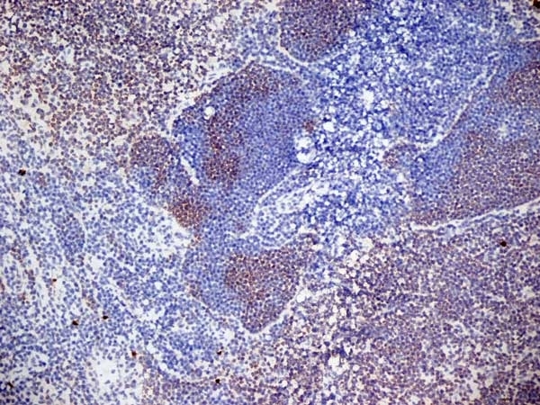 Anti Mouse CD3 Antibody, clone KT3 gallery image 15