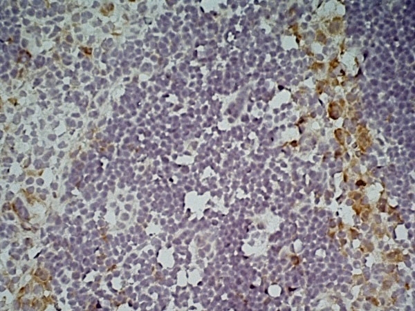 Anti Mouse CD301 Antibody, clone ER-MP23 gallery image 5