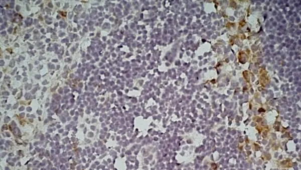 Anti Mouse CD301 Antibody, clone ER-MP23 gallery image 5