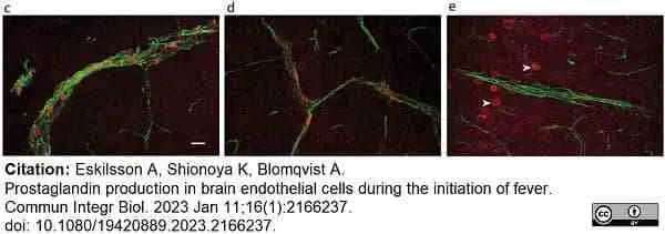 Anti Mouse CD31 Antibody, clone ER-MP12 gallery image 11