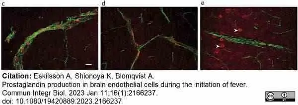 Anti Mouse CD31 Antibody, clone ER-MP12 gallery image 19