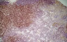 Anti Mouse CD4 Antibody, clone GK1.5 gallery image 2