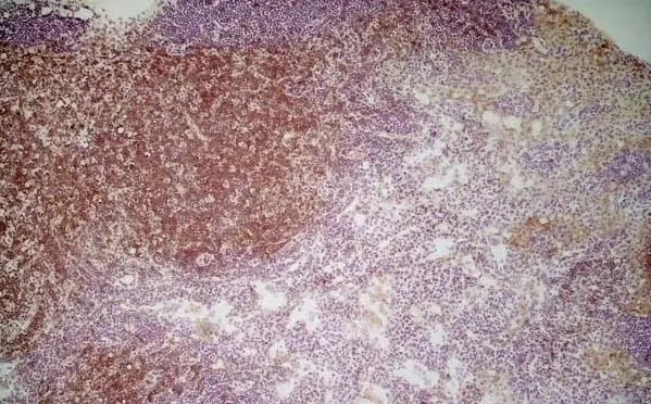 Anti Mouse CD4 Antibody, clone GK1.5 | Bio-Rad