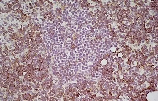 Anti Mouse CD4 Antibody, clone GK1.5 gallery image 4