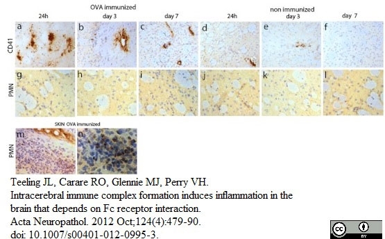 Anti Mouse CD41 Antibody, clone MWReg30 thumbnail image 8