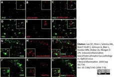 Anti Mouse CD45 Antibody, clone YW62.3 gallery image 3
