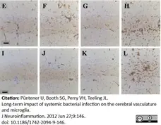 Anti Mouse CD68 Antibody, clone FA-11 gallery image 10