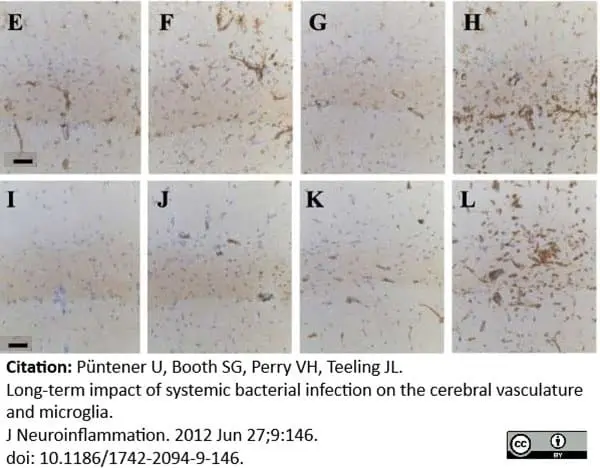 Anti Mouse CD68 Antibody, clone FA-11 gallery image 10