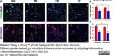 Anti Mouse CD68 Antibody, clone FA-11 gallery image 100