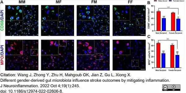 Anti Mouse CD68 Antibody, clone FA-11 gallery image 100