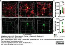 Anti Mouse CD68 Antibody, clone FA-11 gallery image 102