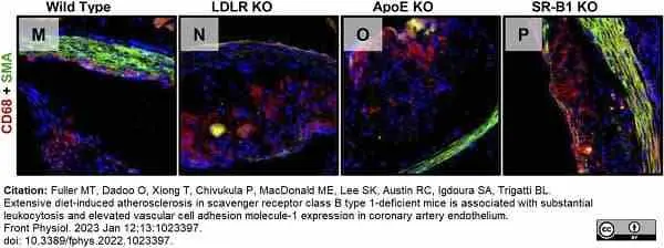 Anti Mouse CD68 Antibody, clone FA-11 gallery image 103