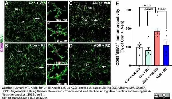Anti Mouse CD68 Antibody, clone FA-11 gallery image 104