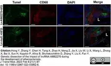Anti Mouse CD68 Antibody, clone FA-11 gallery image 105