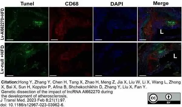 Anti Mouse CD68 Antibody, clone FA-11 gallery image 105