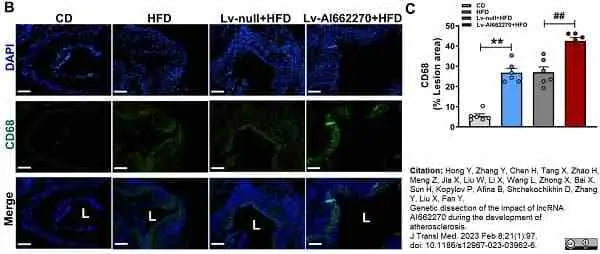 Anti Mouse CD68 Antibody, clone FA-11 gallery image 106