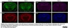Anti Mouse CD68 Antibody, clone FA-11 gallery image 109