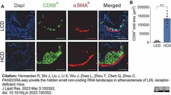 Anti Mouse CD68 Antibody, clone FA-11 gallery image 111