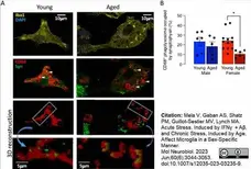 Anti Mouse CD68 Antibody, clone FA-11 gallery image 112