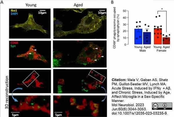 Anti Mouse CD68 Antibody, clone FA-11 gallery image 112
