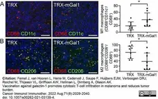 Anti Mouse CD68 Antibody, clone FA-11 gallery image 114