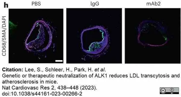 Anti Mouse CD68 Antibody, clone FA-11 gallery image 115