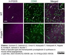 Anti Mouse CD68 Antibody, clone FA-11 gallery image 116