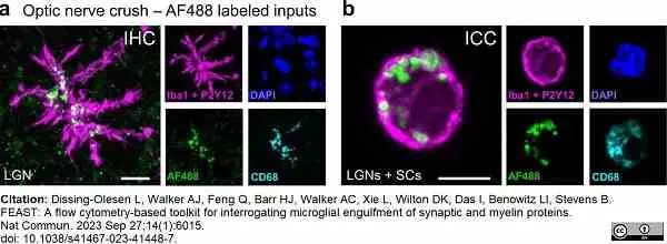 Anti Mouse CD68 Antibody, clone FA-11 gallery image 117