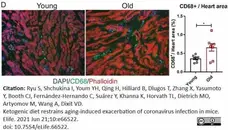 Anti Mouse CD68 Antibody, clone FA-11 gallery image 128