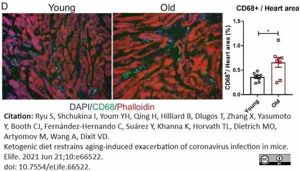 Anti Mouse CD68 Antibody, clone FA-11 gallery image 128