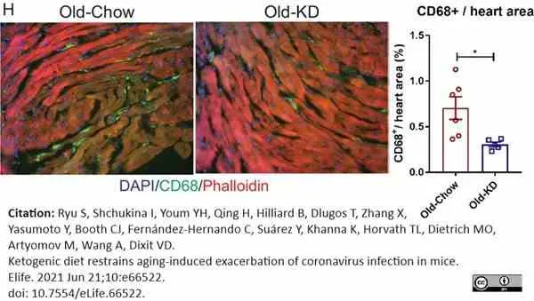 Anti Mouse CD68 Antibody, clone FA-11 gallery image 129