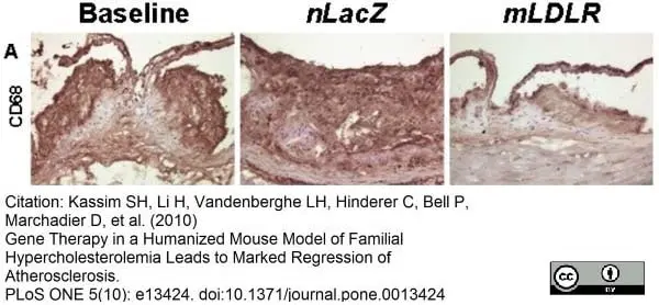 Anti Mouse CD68 Antibody, clone FA-11 gallery image 13