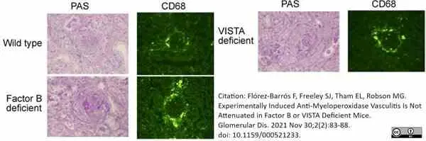Anti Mouse CD68 Antibody, clone FA-11 gallery image 131