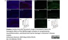 Anti Mouse CD68 Antibody, clone FA-11 gallery image 140