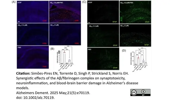 Anti Mouse CD68 Antibody, clone FA-11 gallery image 140