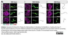 Anti Mouse CD68 Antibody, clone FA-11 gallery image 142