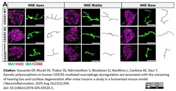 Anti Mouse CD68 Antibody, clone FA-11 gallery image 142