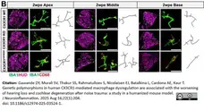 Anti Mouse CD68 Antibody, clone FA-11 gallery image 143
