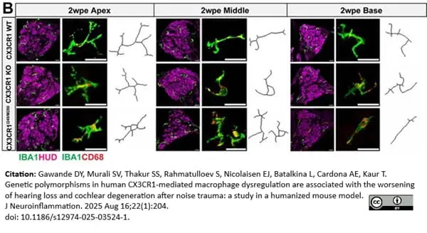 Anti Mouse CD68 Antibody, clone FA-11 gallery image 143