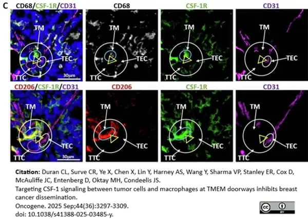 Anti Mouse CD68 Antibody, clone FA-11 gallery image 145