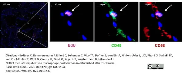 Anti Mouse CD68 Antibody, clone FA-11 gallery image 147