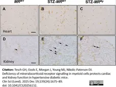 Anti Mouse CD68 Antibody, clone FA-11 gallery image 148