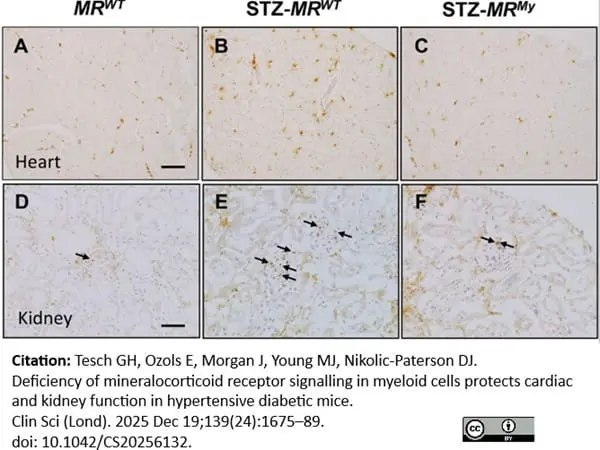 Anti Mouse CD68 Antibody, clone FA-11 gallery image 148