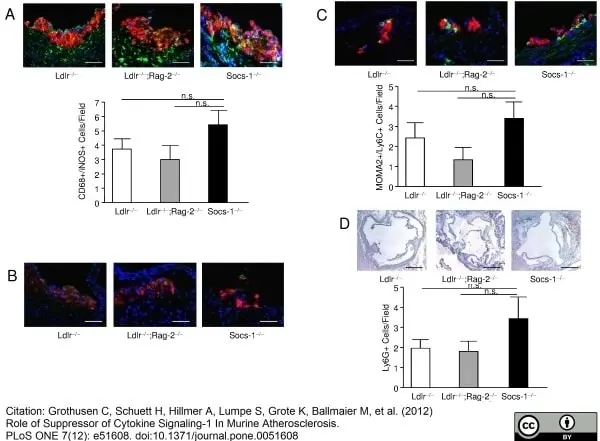 Anti Mouse CD68 Antibody, clone FA-11 gallery image 18
