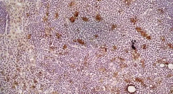 Anti Mouse CD68 Antibody, clone FA-11 gallery image 2