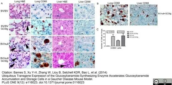 Anti Mouse CD68 Antibody, clone FA-11 gallery image 20
