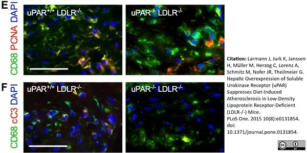 Anti Mouse CD68 Antibody, clone FA-11 gallery image 23